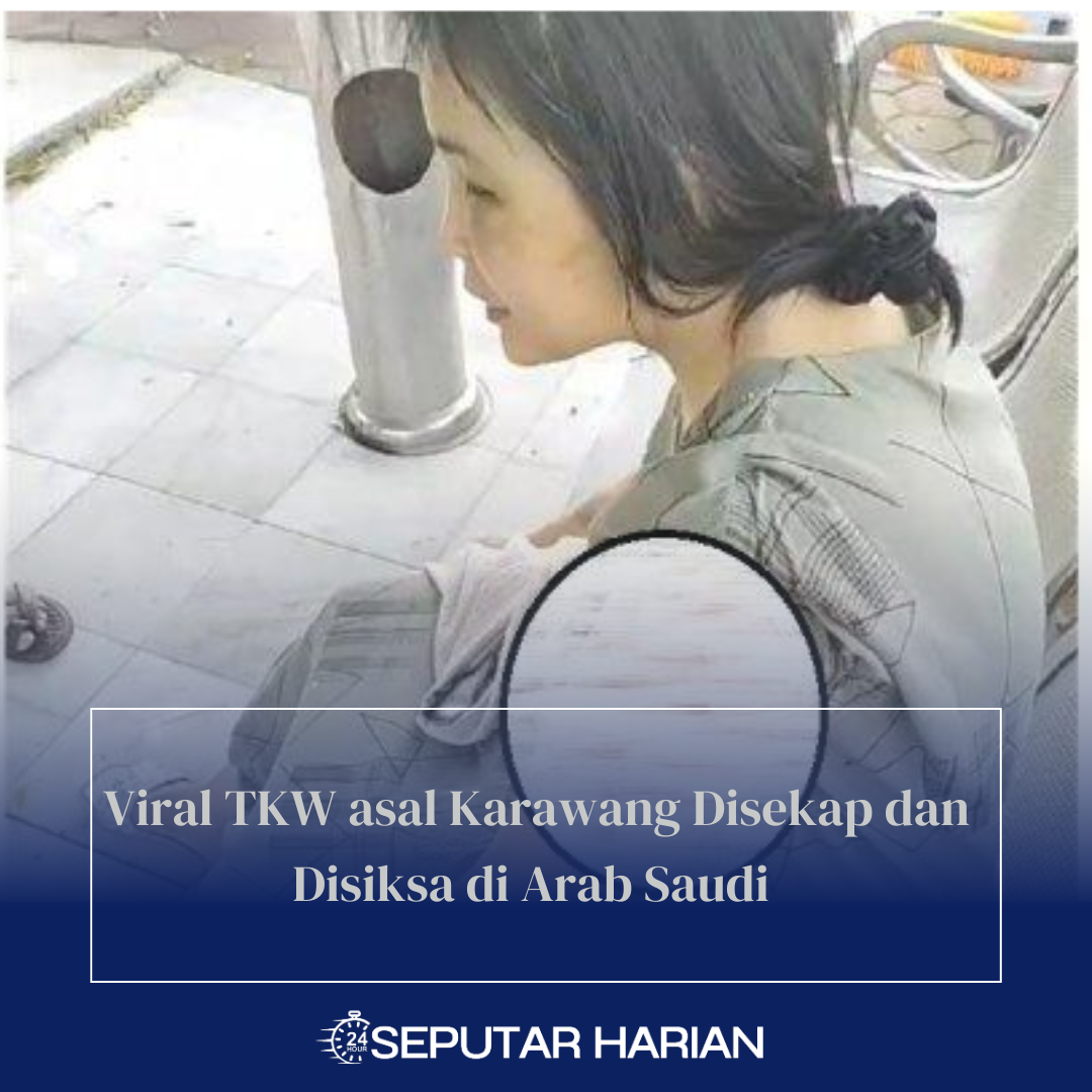 Viral TKW asal Karawang Disekap dan Disiksa di Arab Saudi  